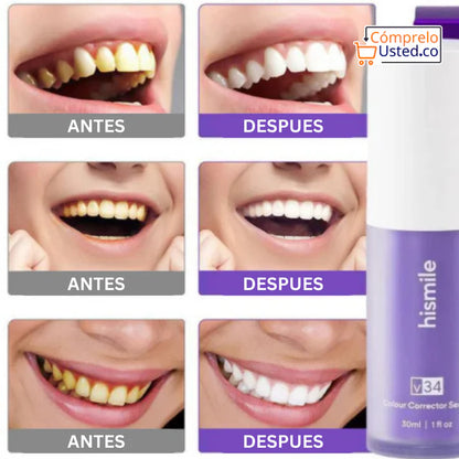 Blanqueadora dental Smilekit